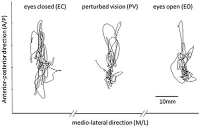 Sample Entropy, Univariate, and Multivariate Multi-Scale Entropy in Comparison with Classical Postural Sway Parameters in Young Healthy Adults